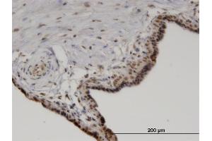 Immunostaining (ISt) image for anti-Protein Phosphatase, Mg2+/Mn2+ Dependent, 1A (PPM1A) (AA 1-382) antibody (ABIN519084)