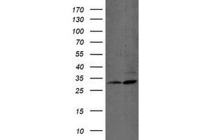 Western Blotting (WB) image for anti-Proteasome (Prosome, Macropain) Subunit, beta Type, 7 (PSMB7) (AA 58-277) antibody (ABIN1491599) (PSMB7 Antikörper  (AA 58-277))