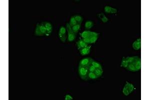 Immunofluorescent analysis of MCF-7 cells using ABIN7161860 at dilution of 1:100 and Alexa Fluor 488-congugated AffiniPure Goat Anti-Rabbit IgG(H+L) (NCOA4 Antikörper  (AA 1-280))