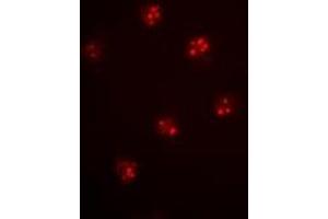 Immunofluorescent analysis of MCM6 staining in Hela cells. (MCM6 Antikörper)