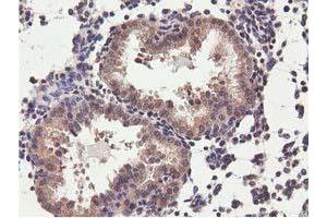 Image no. 12 for anti-COBW Domain Containing 1 (CBWD1) antibody (ABIN1497117) (CBWD1 Antikörper)