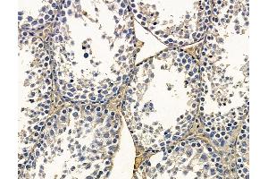 ABIN7095167 and ABIN7099223 at 1/100 staining mouse testis tissue by IHC-P.