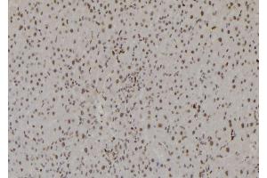 ABIN6277200 at 1/100 staining Rat liver tissue by IHC-P. (Histone 3 Antikörper  (H3K27me3))