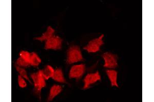 ABIN6267380 staining NIH-3T3 by IF/ICC. (Cyclin B1 Antikörper  (pSer147))