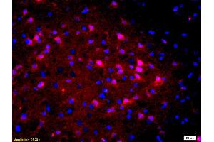 Formalin-fixed and paraffin-embedded rat brain labeled with Anti-Calbindin/Calbindin D28k Polyclonal Antibody, Unconjugated (ABIN703691) 1:200, overnight at 4 °C, The secondary antibody was Goat Anti-Rabbit IgG, Cy3 conjugated used at 1:200 dilution for 40 minutes at 37 °C. (CALB1 Antikörper)