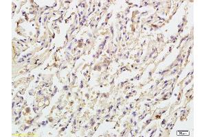 Formalin-fixed and paraffin embedded human endometrial tissue labeled with Anti Caspase-9 p10 Polyclonal Antibody, Unconjugated (ABIN1387603) at 1:200 followed by conjugation to the secondary antibody and DAB staining (Caspase 9 Antikörper  (AA 351-416))