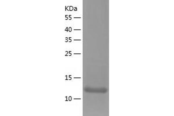 Golgin A7 Protein (GOLGA7) (AA 1-137) (His tag)