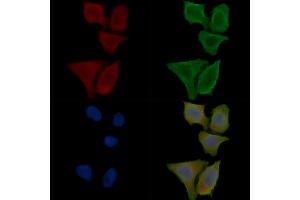 ABIN6264935 and ABIN6276742 staining Hela cells(30 min of UV treatment) by IF/ICC. (SCARB1 Antikörper  (Internal Region))