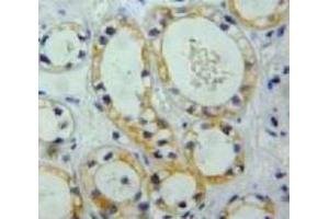 IHC-P analysis of Kidney tissue, with DAB staining. (Nephrin Antikörper  (AA 39-144))