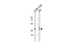 All lanes : Anti-CCD Antibody (C-term) at 1:1000 dilution Lane 1: CCRF-CEM whole cell lysate Lane 2: 293 whole cell lysate Lysates/proteins at 20 μg per lane. (CCDC122 Antikörper  (C-Term))