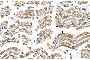 Human Muscle (ALDH4A1 Antikörper  (C-Term))