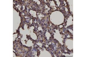 IHC analysis of RAGE/AGER using anti-RAGE/AGER antibody (ABIN7603153). (RAGE Antikörper  (N-Term))