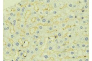ABIN6277044 at 1/100 staining Mouse liver tissue by IHC-P. (AK4 Antikörper  (Internal Region))