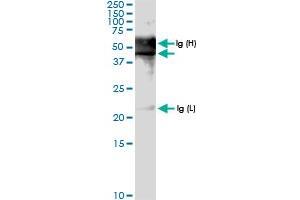Immunoprecipitation of PDCD2 transfected lysate using anti-PDCD2 MaxPab rabbit polyclonal antibody and Protein A Magnetic Bead , and immunoblotted with PDCD2 MaxPab rabbit polyclonal antibody (D01) .