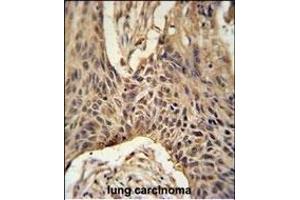 Immunohistochemistry (Paraffin-embedded Sections) (IHC (p)) image for anti-Lipid Phosphate Phosphatase-Related Protein Type 4 (LPPR4) (AA 666-695), (C-Term) antibody (ABIN651164)