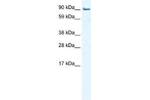 WB Suggested Anti-EPLIN Antibody Titration:  0. (LIMA1 Antikörper  (Middle Region))