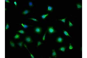 Immunofluorescence (IF) image for anti-Myeloid/lymphoid Or Mixed-Lineage Leukemia (Trithorax Homolog), Translocated To, 11 (MLLT11) (AA 1-90) antibody (ABIN7165023)