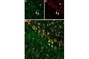 Expression of Ciliary neurotrophic factor (CNTF) in rat hippoccampus - Immunohistochemical staining of rat hippoccampus using Anti-CNTF Antibody (ABIN7043070 and ABIN7044789), (1:200).