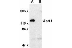 Western blot analysis of Apaf1 in human heart tissue lysate with AP30056PU-N Apaf1 antibody at 1 μg/ml dilution in the absence (A) or presence (B) of blocking peptide. (APAF1 Antikörper  (C-Term))