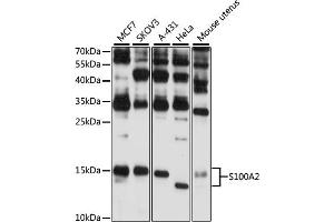 Western blot analysis of extracts of various cell lines, using S100 antibody (ABIN6128692, ABIN6147343, ABIN6147344 and ABIN6216356) at 1:3000 dilution. (S100A2 Antikörper  (AA 1-97))