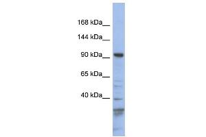 WB Suggested Anti-MYO1C Antibody Titration: 0. (Myosin IC Antikörper  (N-Term))