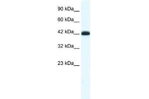 WB Suggested Anti-SLC2A4RG Antibody Titration: 0. (SLC2A4RG Antikörper  (Middle Region))