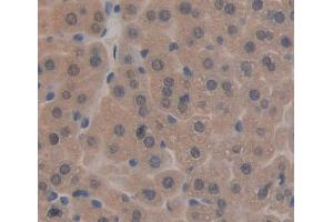 IHC-P analysis of liver tissue, with DAB staining. (TAT Antikörper  (AA 190-454))