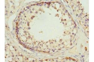 Immunohistochemistry of paraffin-embedded human testis tissue using ABIN7142076 at dilution of 1:100