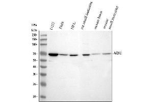 Western blot analysis of WDR1 using anti-WDR1 antibody (ABIN4886763). (WDR1 Antikörper  (C-Term))