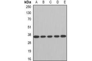 Western blot analysis of AUH expression in A549 (A), SW480 (B), mouse brain (C), mouse kidney (D), rat heart (E) whole cell lysates. (AUH Antikörper)