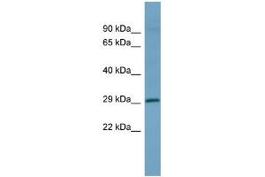 WB Suggested Anti-HOXD1 Antibody Titration: 0.