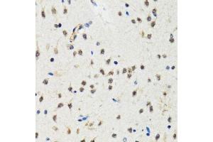 Immunohistochemistry (Paraffin-embedded Sections) (IHC (p)) image for anti-conserved Helix-Loop-Helix Ubiquitous Kinase (CHUK) (C-Term) antibody (ABIN3022825)