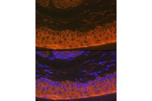 Immunofluorescence analysis of rat skin using Cytokeratin 16 (KRT16) Rabbit mAb (ABIN7268094) at dilution of 1:100 (40x lens). (KRT16 Antikörper)