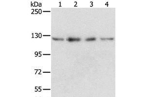 Western Blot analysis of Huvec, hepg2, 293T and A549 cell using RBM5 Polyclonal Antibody at dilution of 1:500 (RBM5 Antikörper)