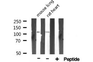 Western blot analysis on various tissue lysate using TAF4 Antibody. (TAF4 Antikörper)