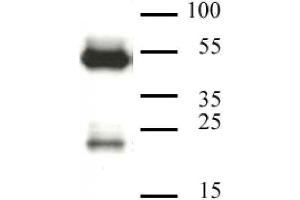 CAF-1 p60 antibody (mAb) tested by Western blot.