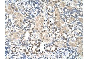 PSAT1 antibody was used for immunohistochemistry at a concentration of 4-8 ug/ml. (PSAT1 Antikörper  (N-Term))