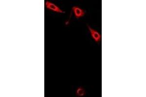 Immunofluorescent analysis of Pinch-1 staining in A549 cells. (LIMS1 Antikörper)