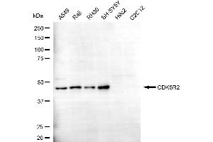 Western blotting analysis using CDK5R2 antibody (ABIN7798218).