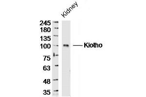 Klotho Antikörper  (AA 401-500)
