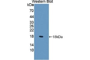 Detection of Recombinant LCNL1, Rat using Polyclonal Antibody to Lipocalin Like Protein 1 (LCNL1) (LCNL1 Antikörper)