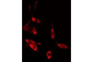 ABIN6275465 staining HeLa cells by IF/ICC. (RAB31 Antikörper  (Internal Region))