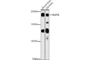 Western blot analysis of extracts of various cell lines, using VEGFR1 antibody (ABIN1683256, ABIN3015026, ABIN3015027 and ABIN6213602) at 1:1000 dilution. (FLT1 Antikörper  (AA 1100-1200))