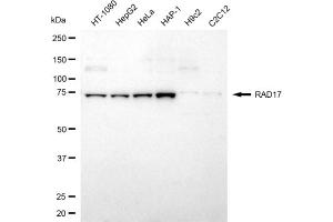 Western blotting analysis using RAD17 antibody (ABIN7800114).