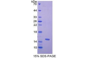 SDS-PAGE analysis of Human Nephrin Protein.