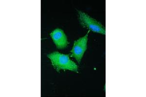 IF analysis of PARN using anti-PARN antibody (ABIN5693032). (PARN Antikörper  (AA 1-301))