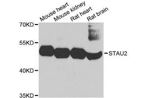 Western blot analysis of extracts of various cell lines, using STAU2 antibody. (Double-stranded RNA-binding protein Staufen homolog 2 (STAU2) (AA 300-400) Antikörper)