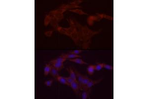 Immunofluorescence analysis of PC-12 cells using DG Rabbit pAb (ABIN6134325, ABIN6139556, ABIN6139557 and ABIN6222582) at dilution of 1:200 (40x lens). (DGAT1 Antikörper  (AA 200-300))