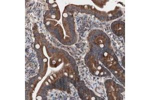 Immunohistochemical staining of human duodenum with CTTNBP2NL polyclonal antibody  shows strong cytoplasmic positivity in glandular cells.