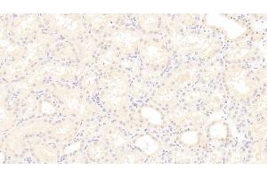 Immunohistochemistry (IHC) image for anti-Chemokine (C-C Motif) Ligand 2 (CCL2) (AA 24-99) antibody (ABIN7428143)